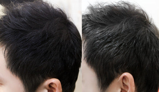 Dashu-Daily-Anti-Hair-Loss-Fixer-Mist-120Ml – beauty &amp; skincare essential for daily radiance