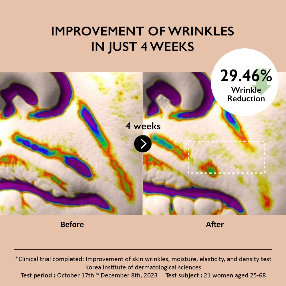 Haruharu-Wonder-Centella-Phyto-5-Peptide-Concentrate-Cream-30Ml – beauty & skincare essential for daily radiance