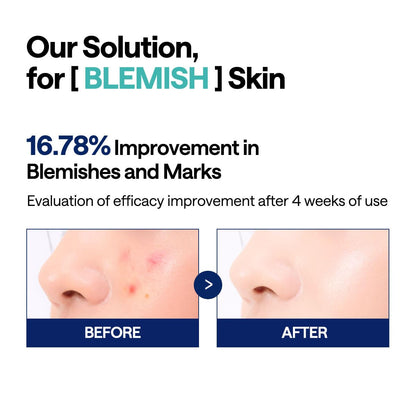 MEDIHEAL Madecassoside Blemish 100 Pads