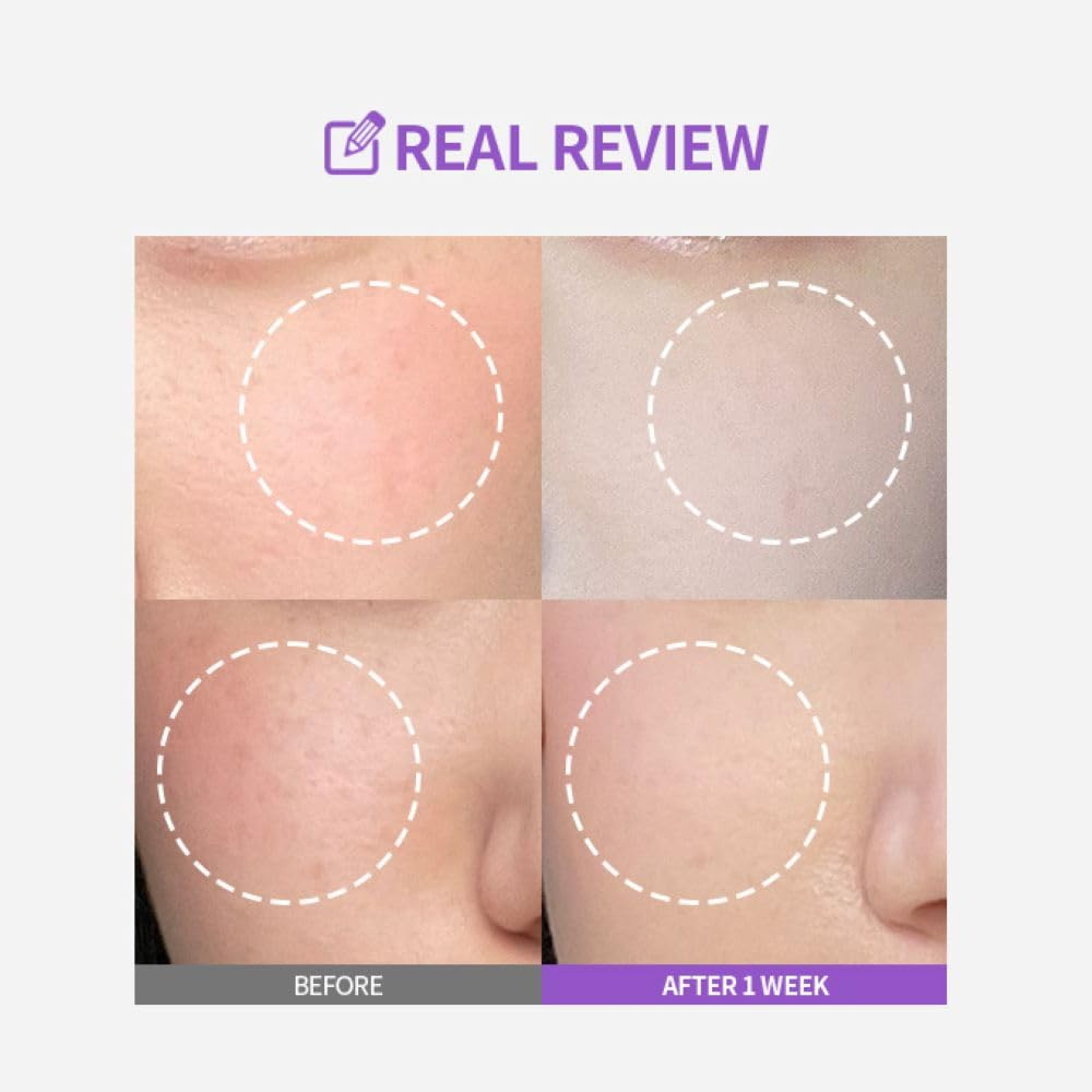 SUNGBOON EDITOR Meoru Podo Vita C Dark Spot Ampoule 30ml